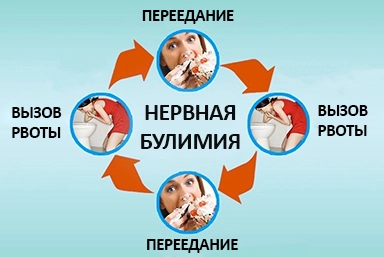 Лечение булимии в Радужном